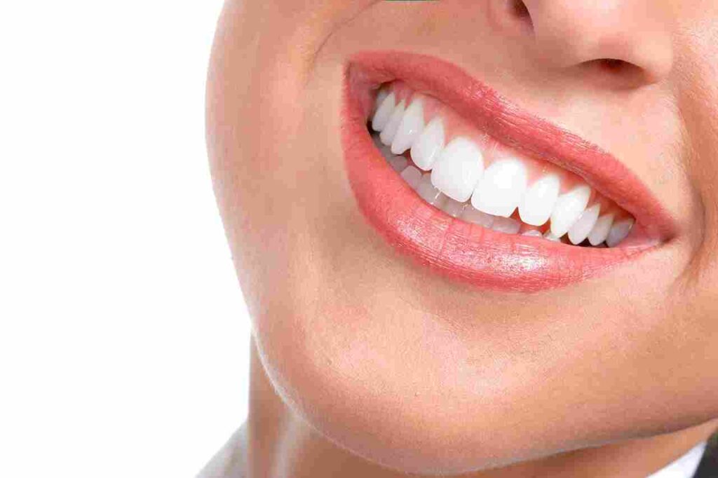 Teeth Whitening - Burki Dental DHA Karachi